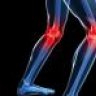 rheumatic