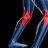 rheumatic